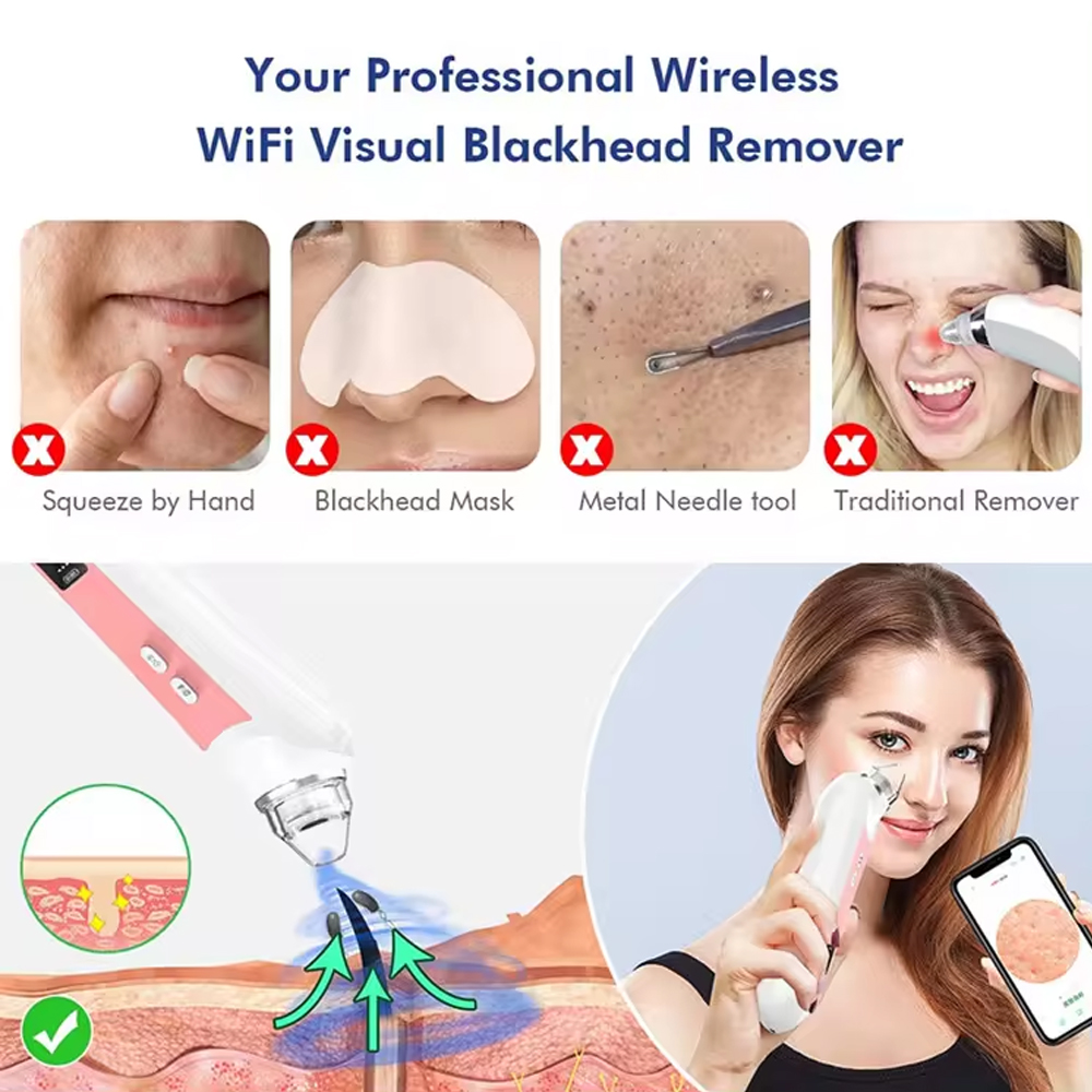 مكنسة كهربائية للرؤوس السوداء  - مراجعة Nasal Aspirator وسعره