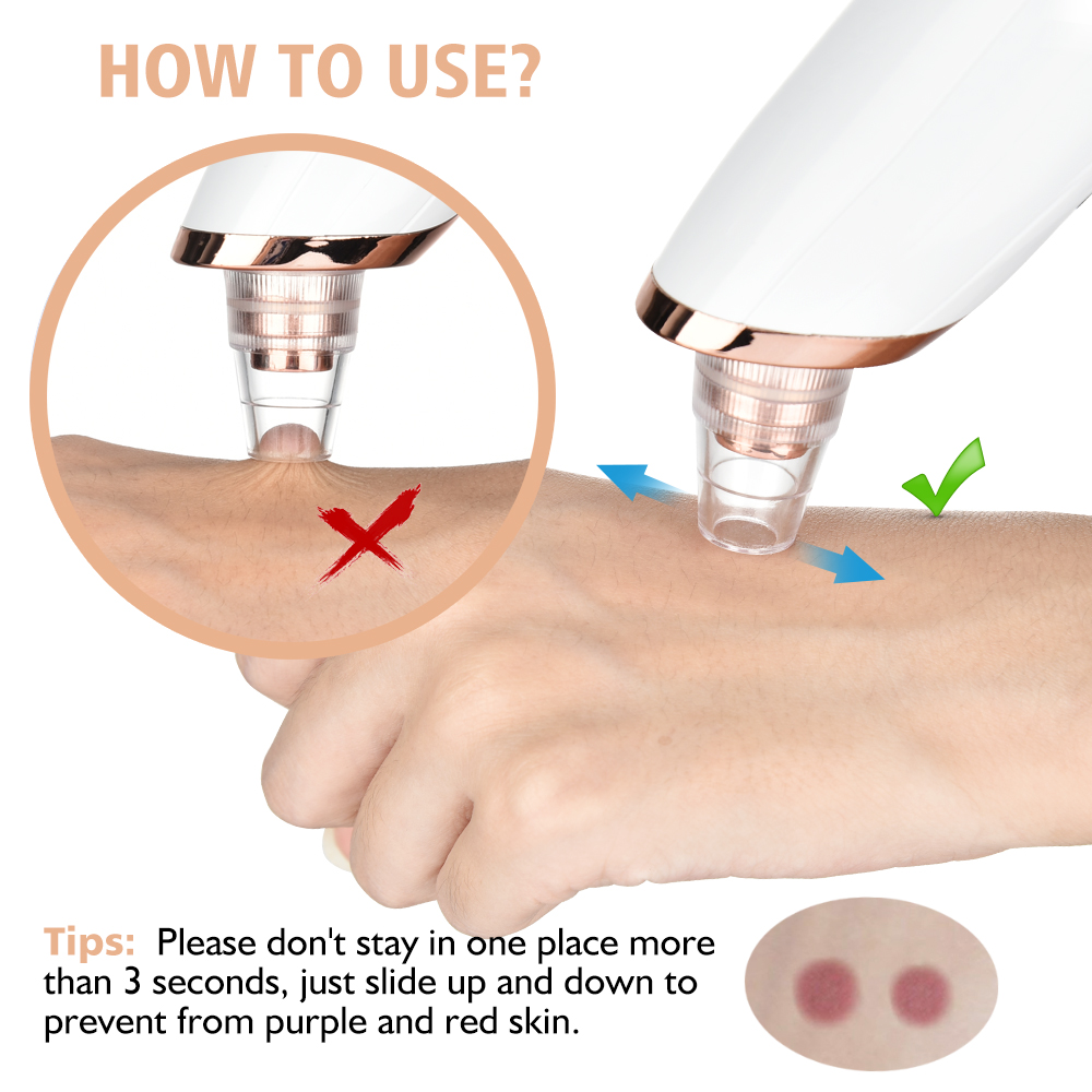 البثرة مزيل فراغ المسام نظافة  - مراجعة Nasal Aspirator وسعره